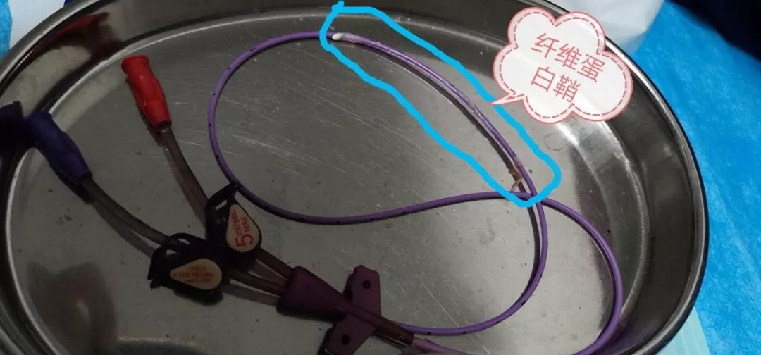口导管结的SEO优化文章，口导管结的SEO优化指南