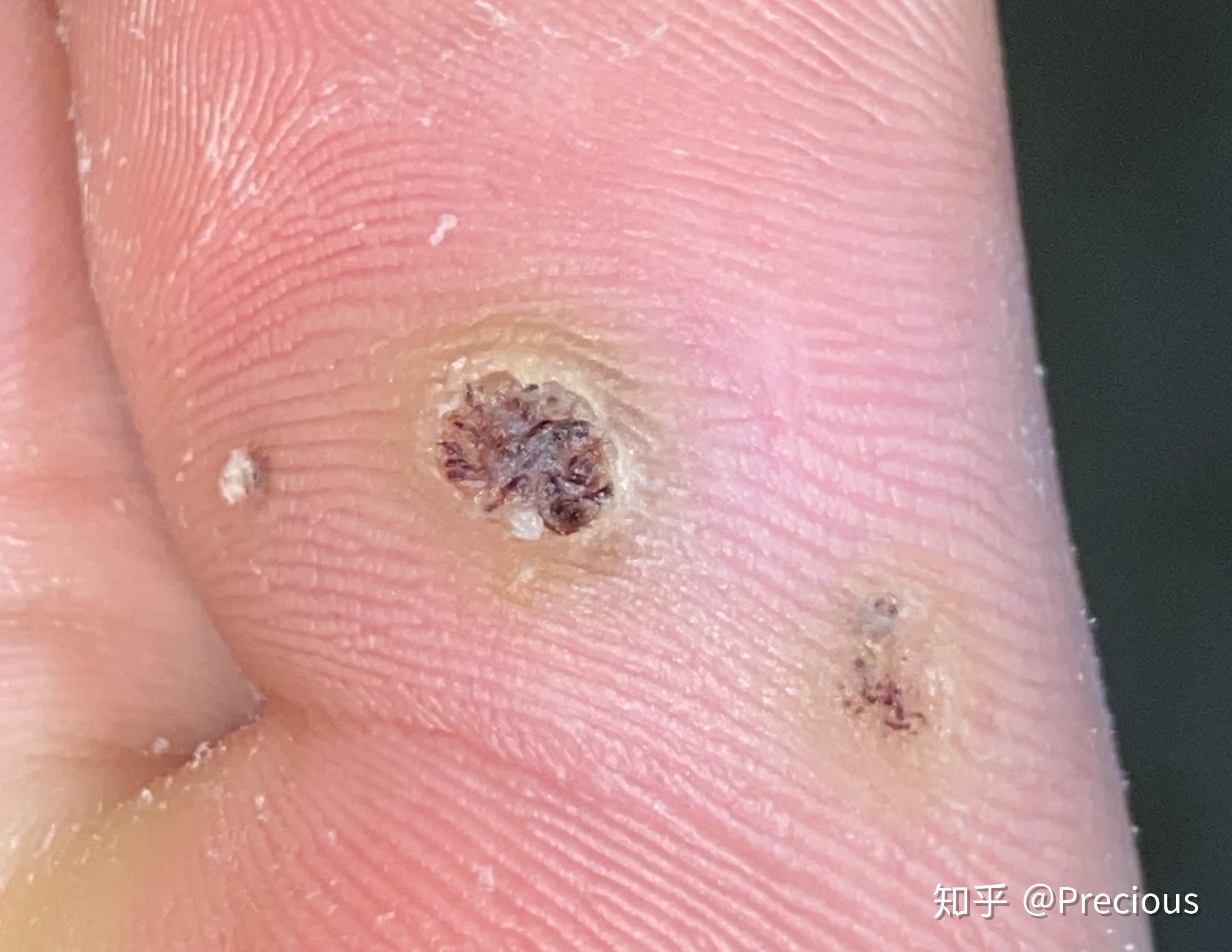 关于击视真奖简特疣的全面解析，击视真奖简特疣全面解析指南