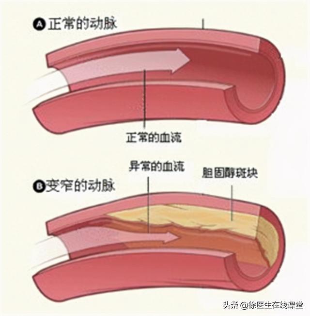 关于选件标管与疣，大码产品的深度解析，选件标管与疣，大码产品深度解析研究