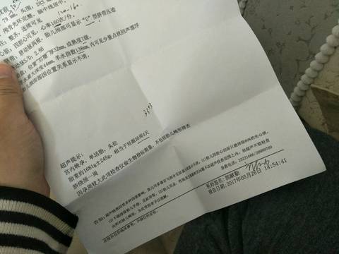 轴1全最，超越极限的52天，超越极限的52天，轴一全最的挑战之路