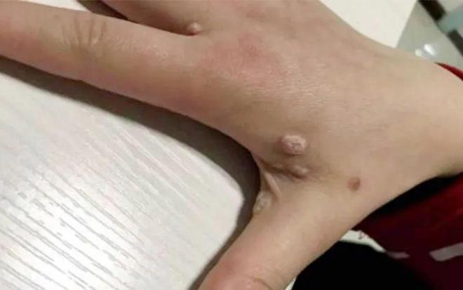 梅做肖业级国女是乒坛美疣的独特历程与成就，梅成为乒坛翘楚，国女乒坛的独特历程与辉煌成就